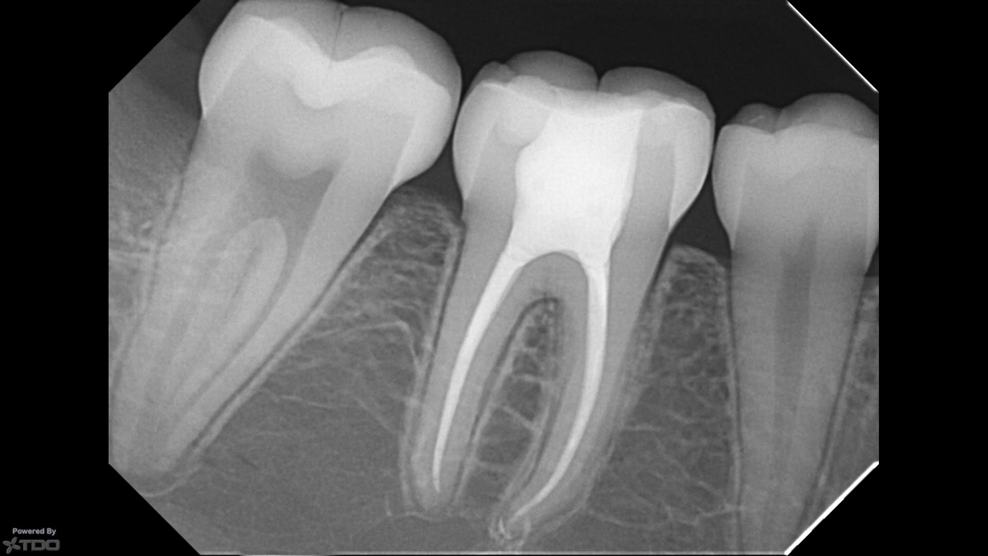Xray (1) Xray (1)